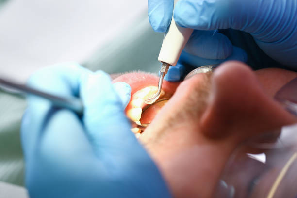 Best Emergency Dentist for Special Needs Patients in Round Lake Heights, IL